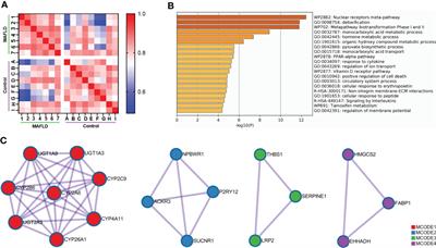 IRX3 plays an important role in the pathogenesis of metabolic-associated fatty liver disease by regulating hepatic lipid metabolism